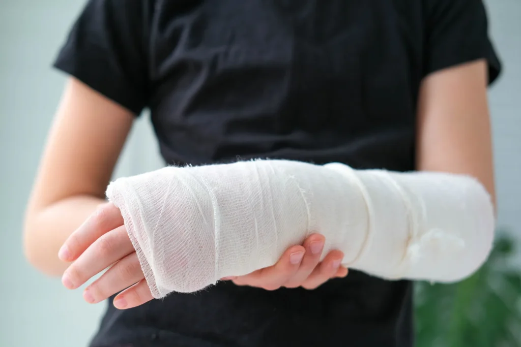 An injured arm wrapped in gauze.